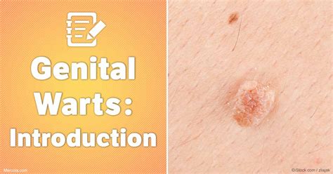 Genital Warts: Introduction