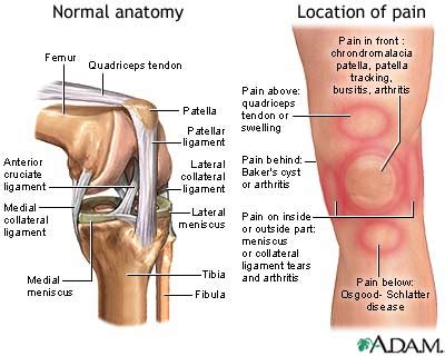 Knee pain: MedlinePlus Medical Encyclopedia