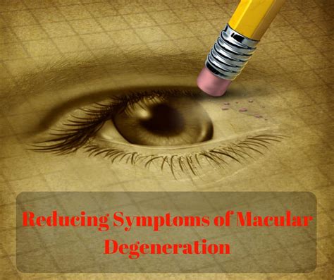 How to Reduce Symptoms of Dry Macular Degeneration – Wiles Eye Center