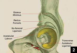 The Transverse Acetabular Ligament: Optimizing Version