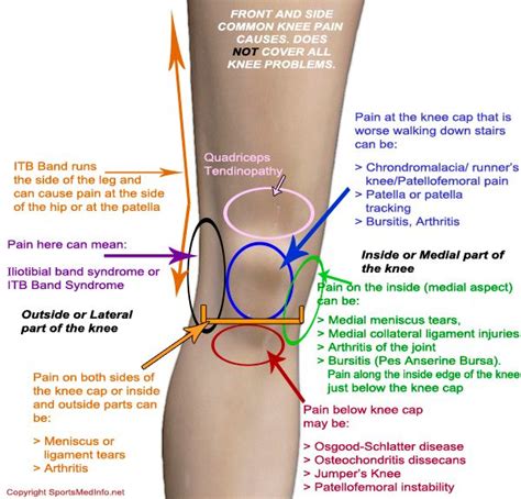 Knee Pain Location Chart | The Chelsea Knee Clinic