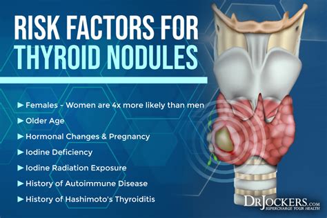 thyroid tumor symptoms - Rock Utility