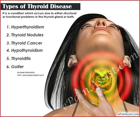 Thyroid Disease | Types | Causes | Symptoms | Treatment | Prognosis ...