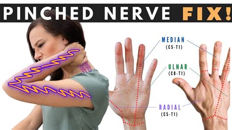 How to Fix a Pinched Nerve in the Neck | Dr. Jon Saunders - YouTube