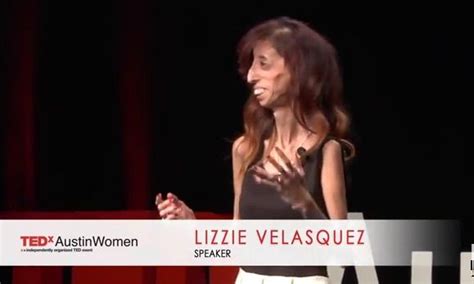 What Defines You? || Tedx Austin || Lizzie Velasquez | Lizzie velásquez ...