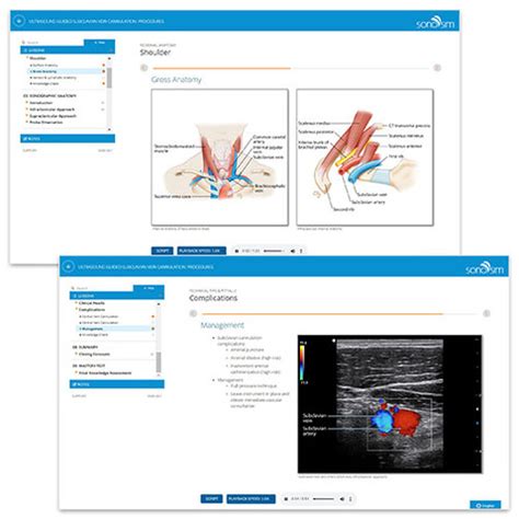 Subclavian Vein Ultrasound - Subclavian Artery Ultrasound