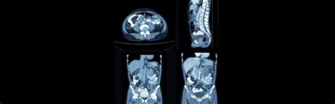 Is CECT Whole Abdomen Painful? | Ganesh Diagnostic