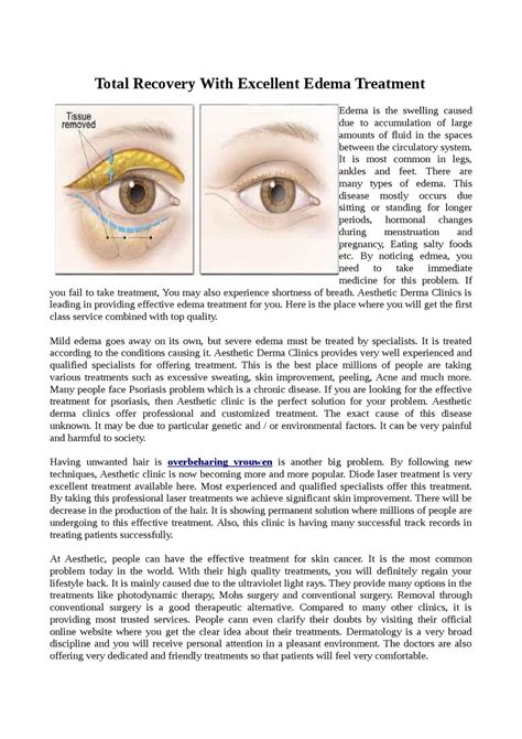 Total Recovery With Excellent Edema Treatment by basil tone - Issuu