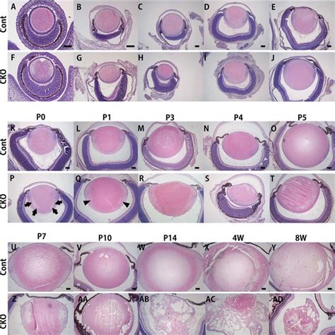 The sequential histology of the lens at the indicated time points in ...