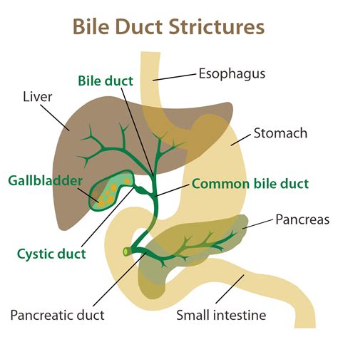 New American guidelines on how to deal with a blocked bile duct