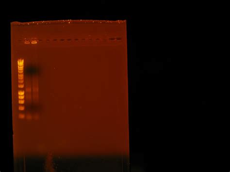 What is the problem of my RNA extraction method? | ResearchGate