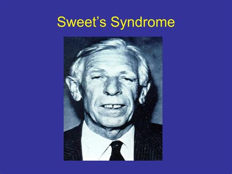 PPT - Sweet’s Syndrome PowerPoint Presentation, free download - ID:6015788