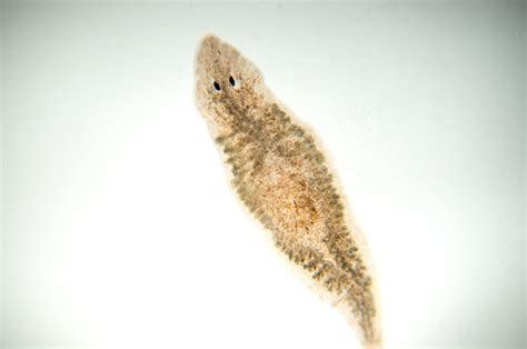 Planaria Flatworm Under Microscope View Stock Photo - Download Image ...