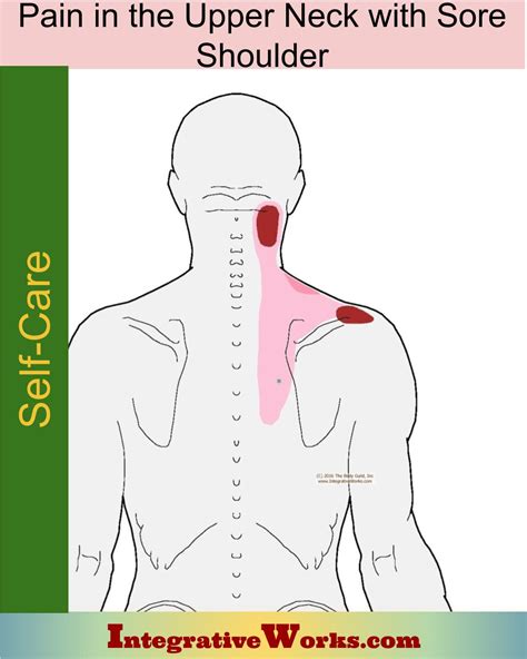 Self Care - Neck Pain with Sore Shoulder - Integrative Works