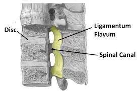 Ligamentum Flavum - Anatomy, Structure, Function