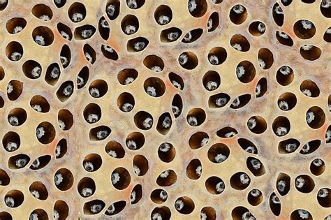 What is Trypophobia? - WorldAtlas.com