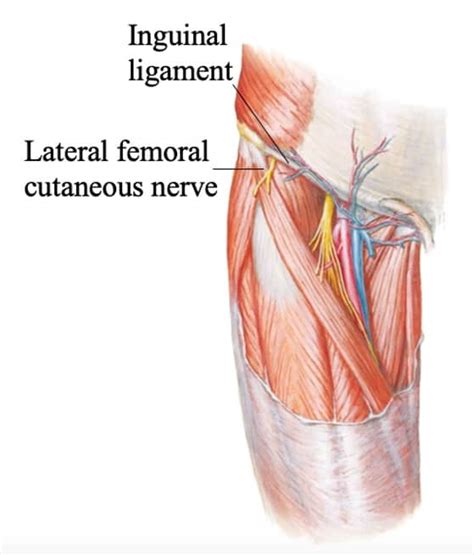 Meralgia Paresthetica: Lateral Femoral Cutaneous Nerve Entrapment