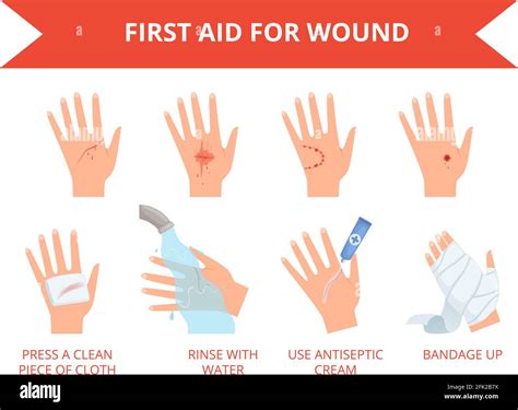 Wound skin treatment. First emergency help for human hand trauma ...