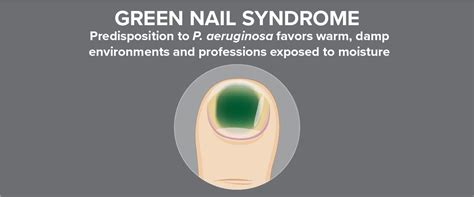 Pseudomonas aeruginosa Test for Green Nail Syndrome - Bako Diagnostics