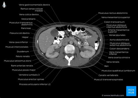 Abdomen Ct Was Sieht Man - Captions Beautiful