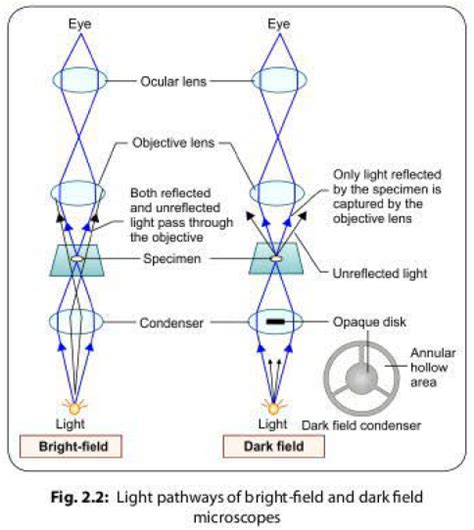 Microscopy in Microbiology : Different Types of Microscopes