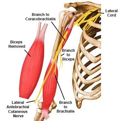 Musculocutaneous nerve injury: Symptoms, Treatment, Exercise