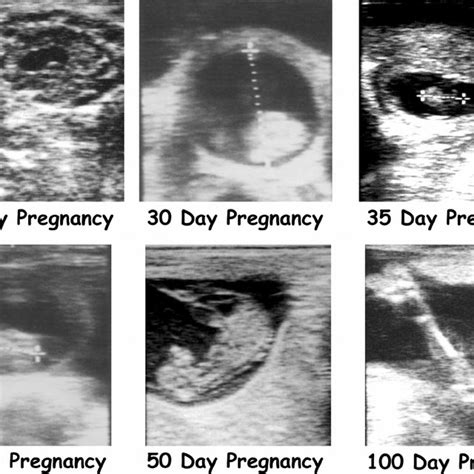 Fetal Development Cow Pregnancy Stages