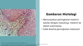 Oral Melanotic Macule-3.pptx