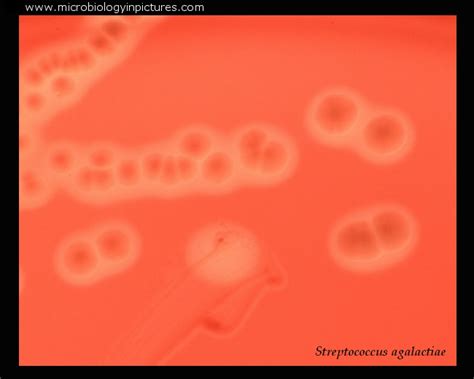 Streptococcus Agalactiae Gram Stain