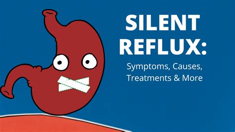 Silent Reflux | Symptoms, Causes, Treatments & More – OrangeBurps.com ...