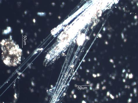 Chrysotile Asbestos Under the Microscope