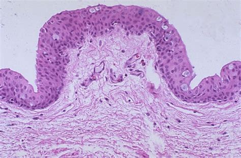 Conjunctiva Histology