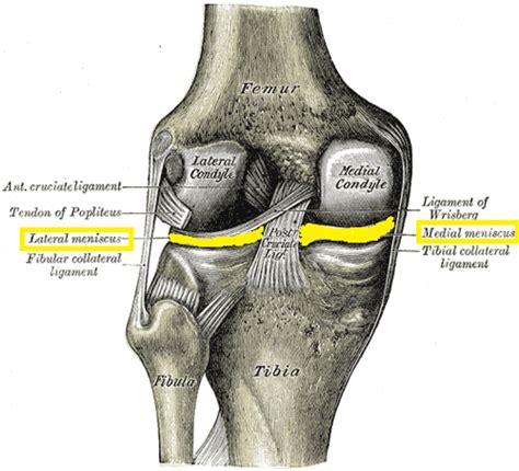 Degenerative Meniscus Tear - Carolinas Pain Center - Chronic Conditions