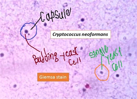 Cryptococcus Neoformans Csf Gram Stain