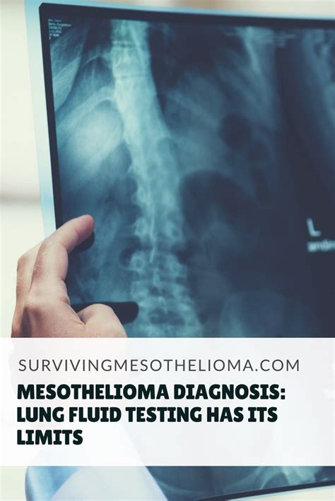 Death Rate Of Malignant Mesothelioma