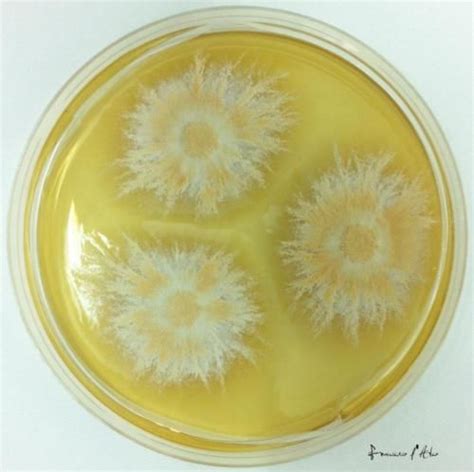 Microsporum gypseum su Sabouraud Agar Microscopy, Agar, Fungi, Decay ...