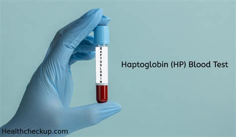 Haptoglobin Test: Purpose, Procedure & Results