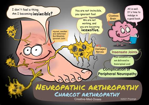 Neuropathic arthropathy: Charcot arthropathy - Creative Med Doses