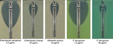 Interpretation of Etest results. C/T Etest strips were placed onto ...