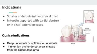 Bar Clasp | PPT