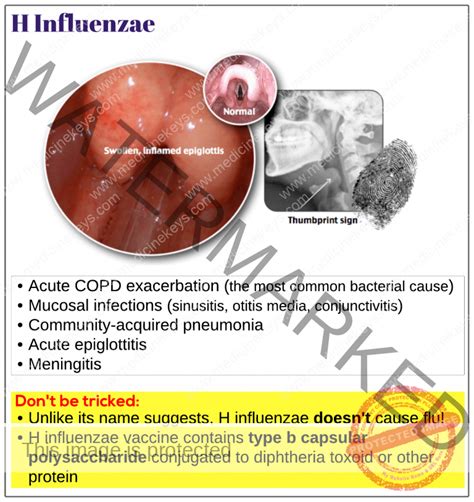 Haemophilus influenzae - Medicine Keys for MRCPs