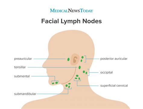 Swollen Lymph Nodes In Neck