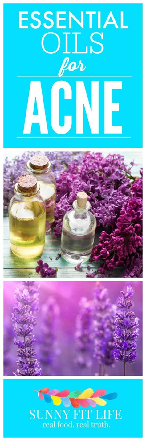 Essential Oils for Acne - Natural Treatment for Clear Skin!