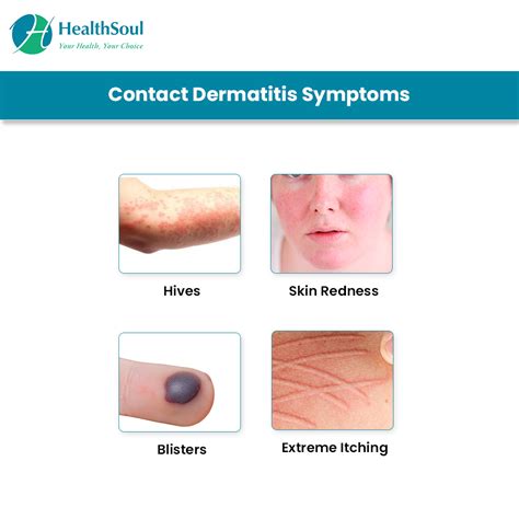 Contact Dermatitis: Causes, Diagnosis and Treatment | Dermatology ...