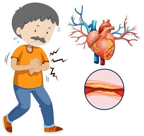 Heart Disease Cartoon