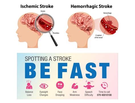 Neurosurgery in Brain Stroke Treatment by HCG Hospitals