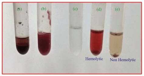 Photographic images of hemolysis assay: RBCs and blood plasma (a), RBCs ...