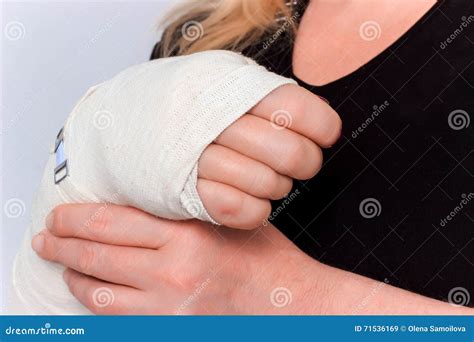 Young Female with Broken Hand in Cast Stock Image - Image of accident ...