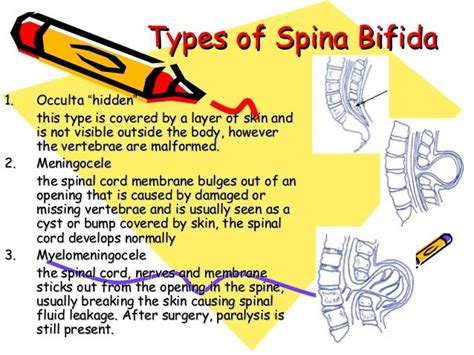 4 signs, symptoms and causes of spina bifida