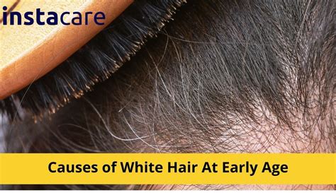 What Causes White Hair At Early Age?